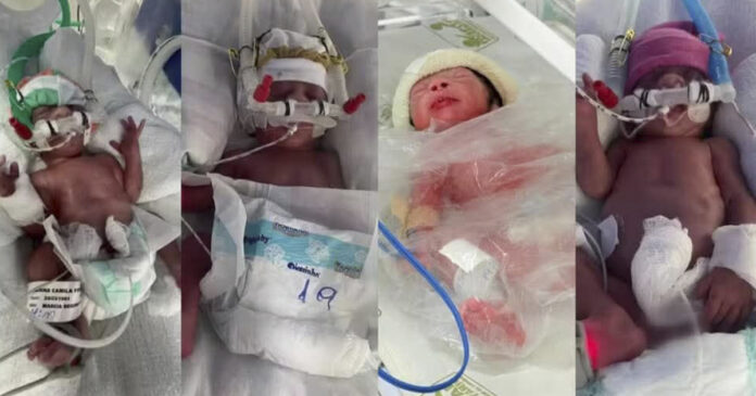 Quadrigêmeos nascem Paraná após casal esperar quatro anos