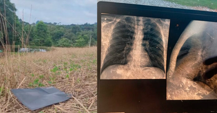 Exame de Raio-X de Rio Bonito do Iguaçu Voa até Mallet